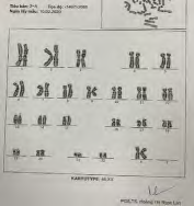 Siêu âm bất thường 2